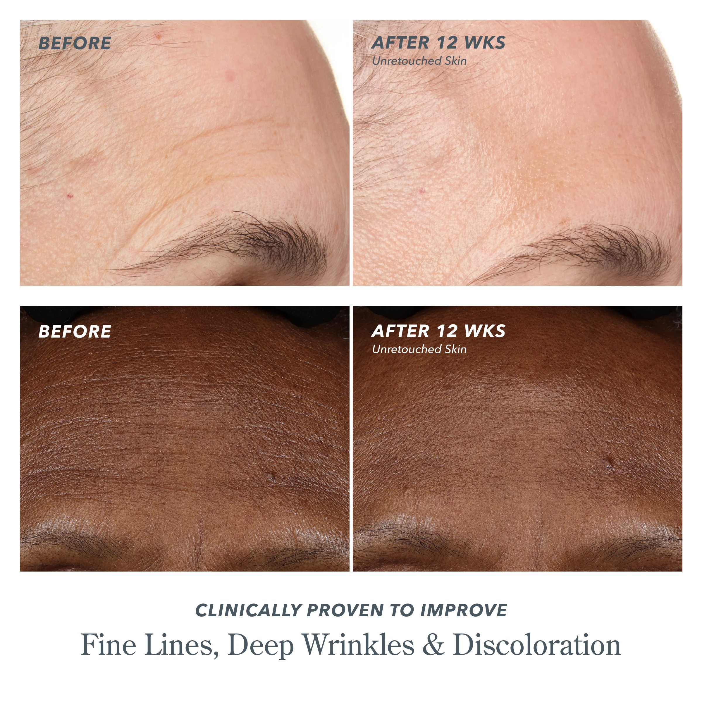 Milk RX Advanced Better Aging Wrinkle Serum - Image 4